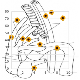 Fukuyama-type muscular dystrophy