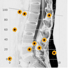 Brachycephalofrontonasal dysplasia