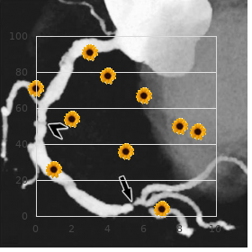 Fructose-1,6-bisphosphatase deficiency