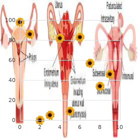 Polydactyly