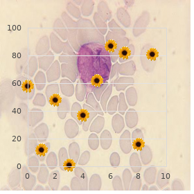 Marfanoid hypermobility