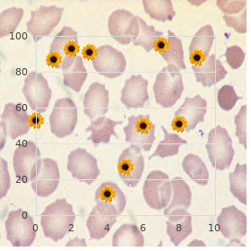 Congenital articular rigidity