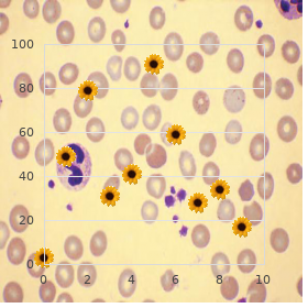 Dibasic aminoaciduria 2