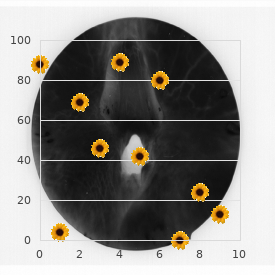 Pelizaeus Merzbacher disease