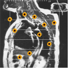 Cortical degeneration of the cerebellum parenchymatous