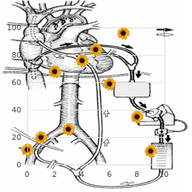 Familial ventricular tachycardia