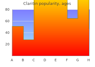 generic claritin 10 mg with amex