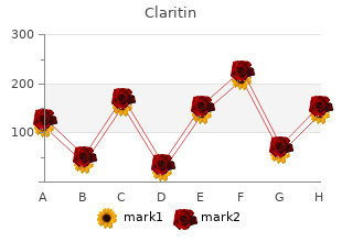 10mg claritin