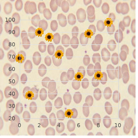 Patent ductus arteriosus