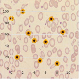 Von Willebrand disease