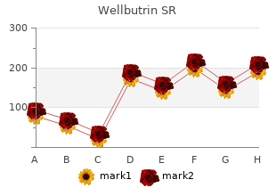 order 150mg wellbutrin sr amex