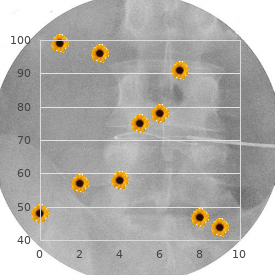 Muscular dystrophy white matter spongiosis