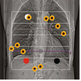 Gas/bloat syndrome