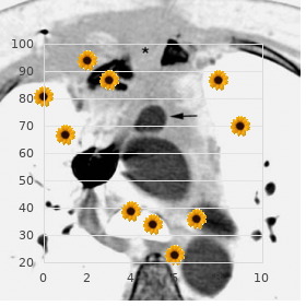 Myositis ossificans post-traumatic