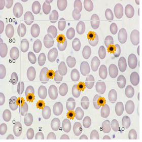 Bannayan Zonana syndrome