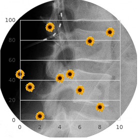 Infantile convulsions and paroxysmal choreoathetosis, familial