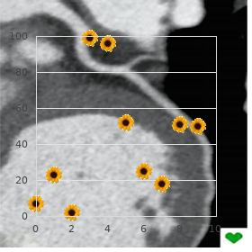 Costochondritis (otherwise Costal chondritis)