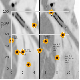 Hereditary hyperuricemia