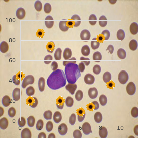 Idiopathic thrombocytopenic purpura