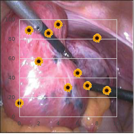 Trichodental syndrome