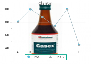 order genuine claritin line