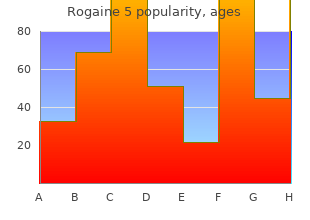 generic rogaine 5 60  ml fast delivery