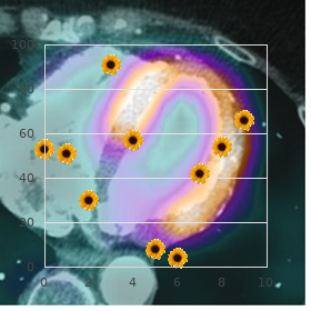 Transient global amnesia