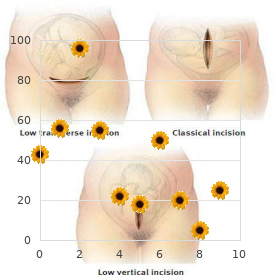 M?llerian aplasia