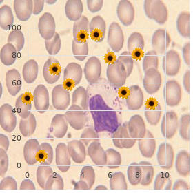 Osteosclerose type Stanescu