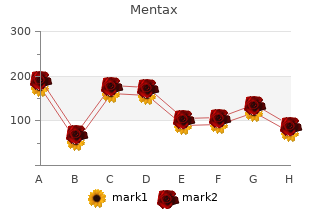 order mentax 15mg mastercard