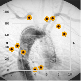 Otospondylomegaepiphyseal dysplasia