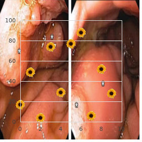 Valproic acid antenatal infection