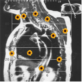 Nemaline myopathy, type 1