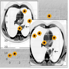 Phenylketonuric embryopathy