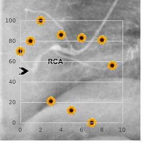 Pulmonary valve stenosis