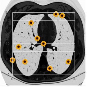 Congenital adrenal hyperplasia due to 11?-hydroxylase deficiency