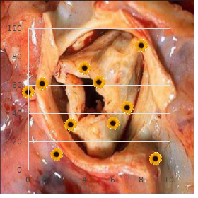 Vasculitis hypersensitivity