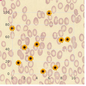 Omodysplasia type 1