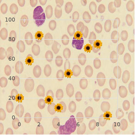 Cardiofaciocutaneous syndrome