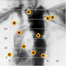 Continuous spike-wave during slow sleep syndrome