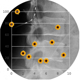 Glaucoma sleep apnea