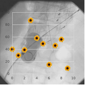 Chromosome 2, monosomy 2q24