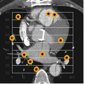 Cerebro oculo skeleto renal syndrome