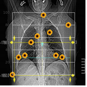 B?b? Collodion syndrome