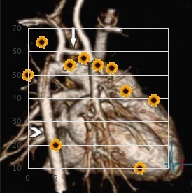 Infantile convulsions and paroxysmal choreoathetosis, familial