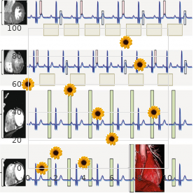 Microphthalmia microtia fetal akinesia