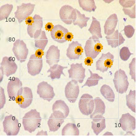 Radioulnar synostosis retinal pigment abnormalities