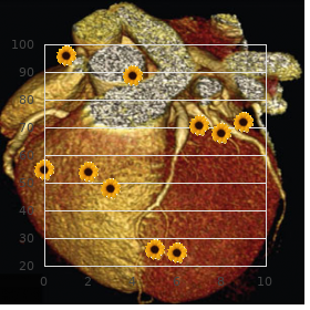 Olivopontocerebellar atrophy type 1