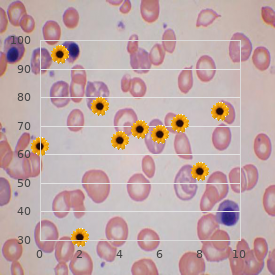 Idiopathic pulmonary haemosiderosis