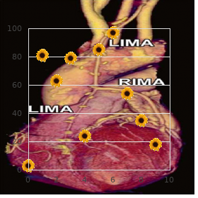 McCune Albright syndrome